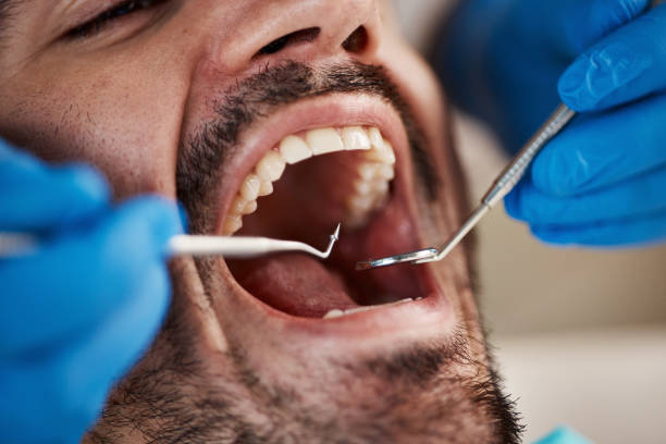 Emergency Dental Services in Newburgh, IN